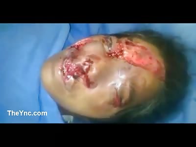 REAL LIFE HALLOWEEN MASK: (Woman Still Alive) **VERY DISTURBING**