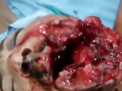 [GRAPHIC] Man Survives Shotgun Blast To The Face 