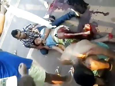 HORRIBLE Leg Injury Leaves Bone Exposed