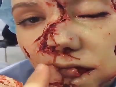  you drop the face of shame