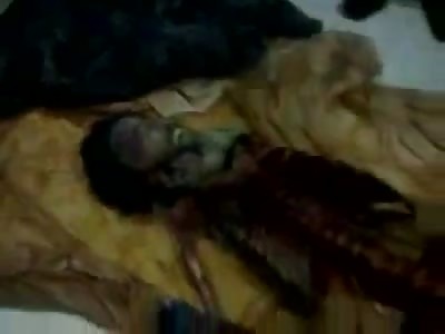 A skeleton with intact head and feet burned to the bones. 