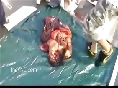 Man Shredded Into Globular Mass