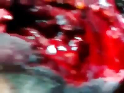 man took the shot queicho 