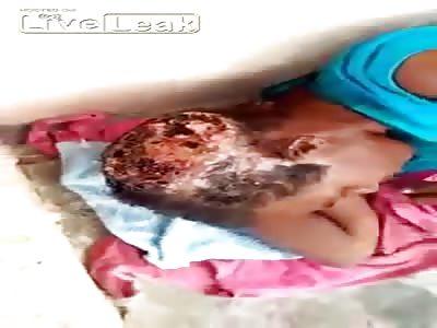 SHOCKING!!! this woman in republica dominicana is been eaten slowly by worms!!! esta mujer en republica dominicana esta siendo comida lentamente por los gusanos!!!