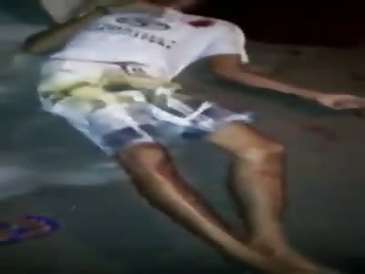 Man Killed by Shot in the Head with Bloodied Face