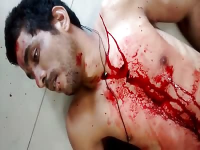 Man in Agony After Struck by Knife.