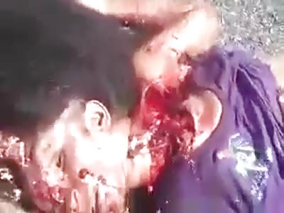 victim of tragic accident