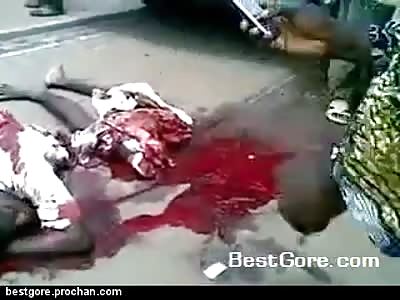 Man Cut in Half but Still Alive