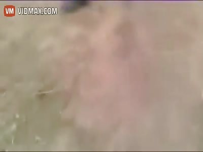 Boy shot in the head takes his last breath as his brains hang out