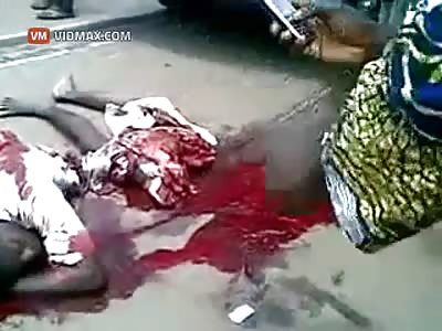 Extremely graphic! Man ripped in half still alive